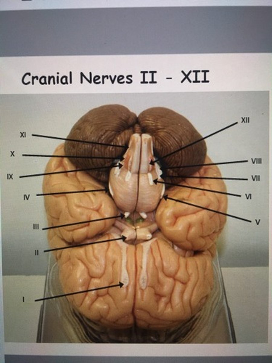 <p>XI</p>