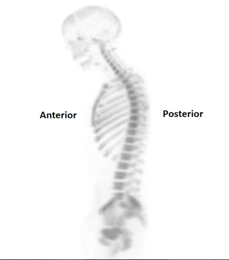 <p><span><span>What view does the image below demonstrate?</span></span></p>