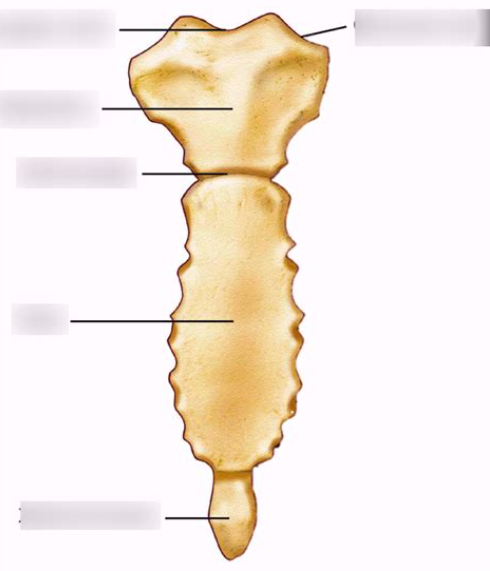 <p>What bone is this?</p>