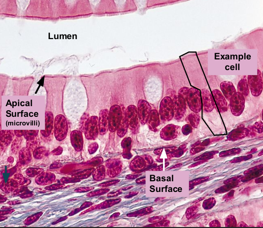 <p>protection; intestinal wall&nbsp;</p>