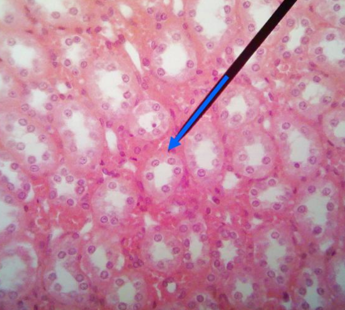 <p>What surface is the arrow pointing to?</p>