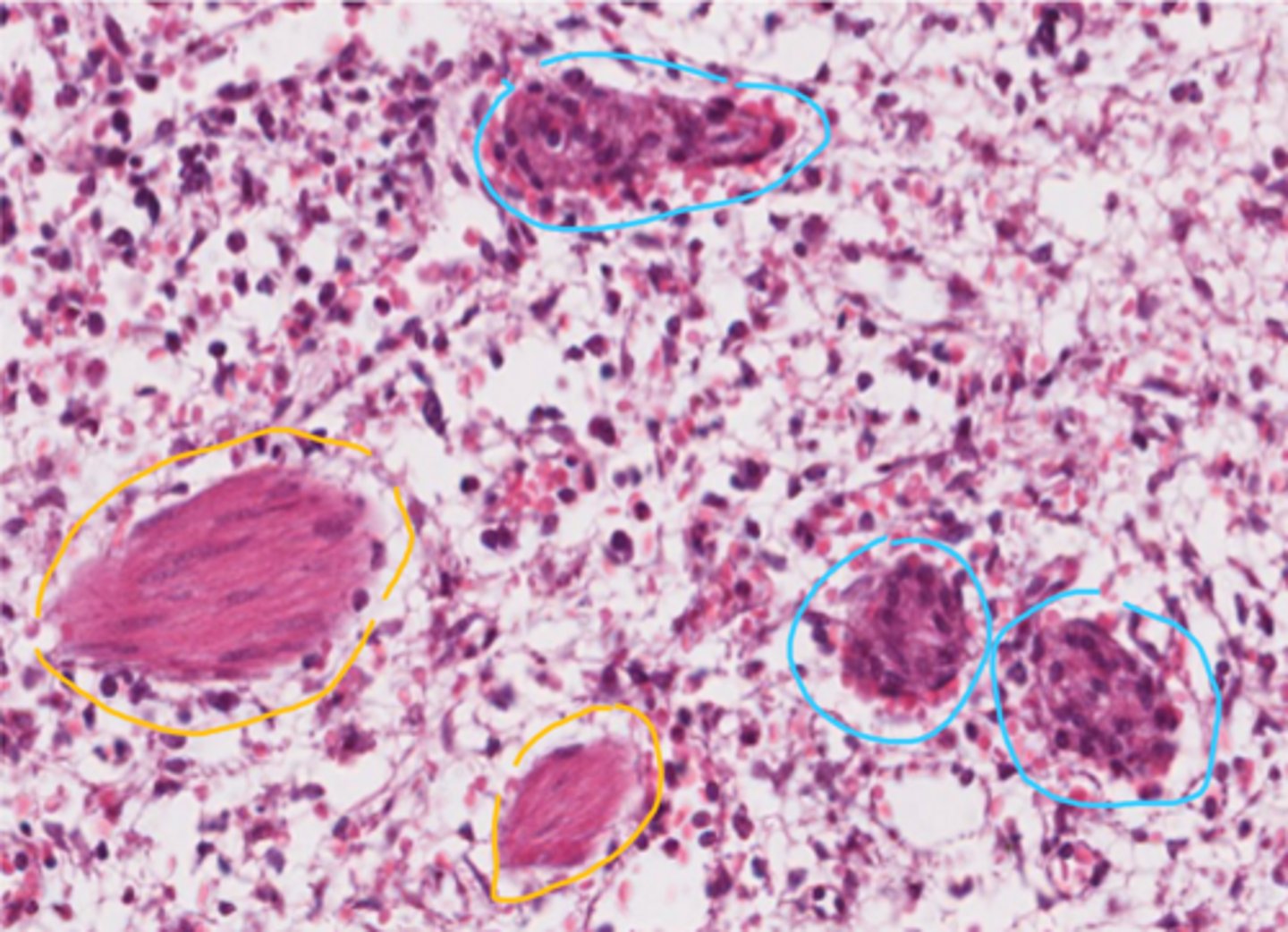 <p>yellow (note cigar nuclei)</p>