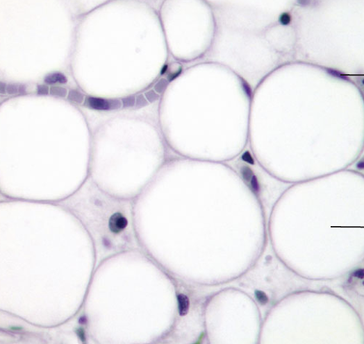 <p>What tissue type does this image depict?</p>