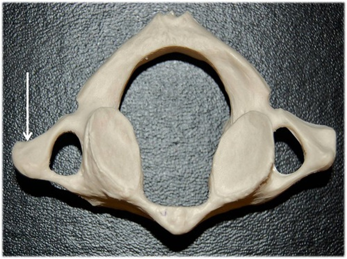 <p>2 lateral projections from the body</p>