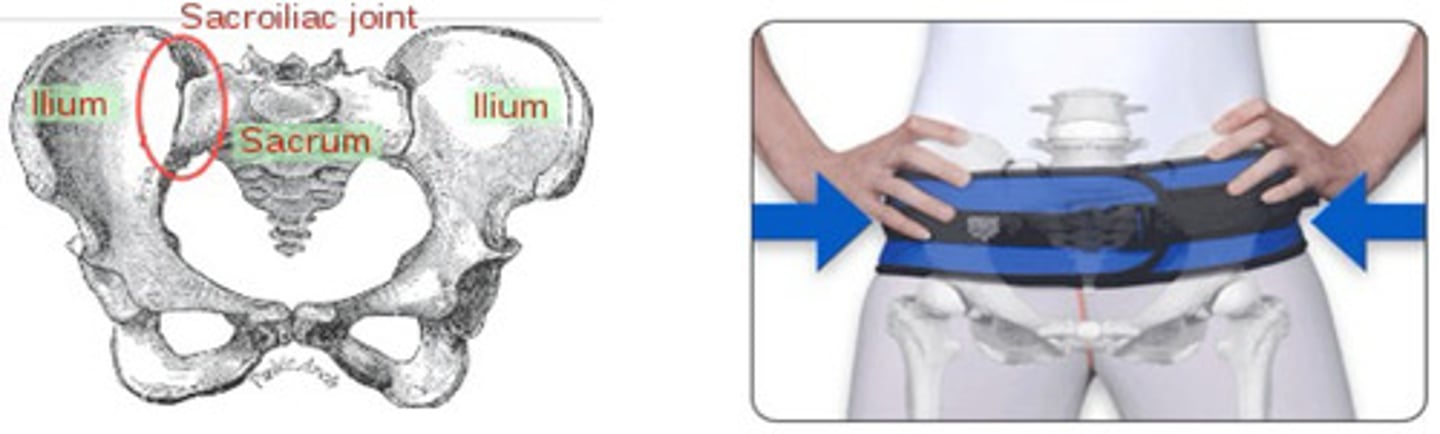 <p>sacroiliac belt (SI belt)</p><p>applies medially directed forces bilaterally on iliac crests (reduces motion at SI joint)</p>