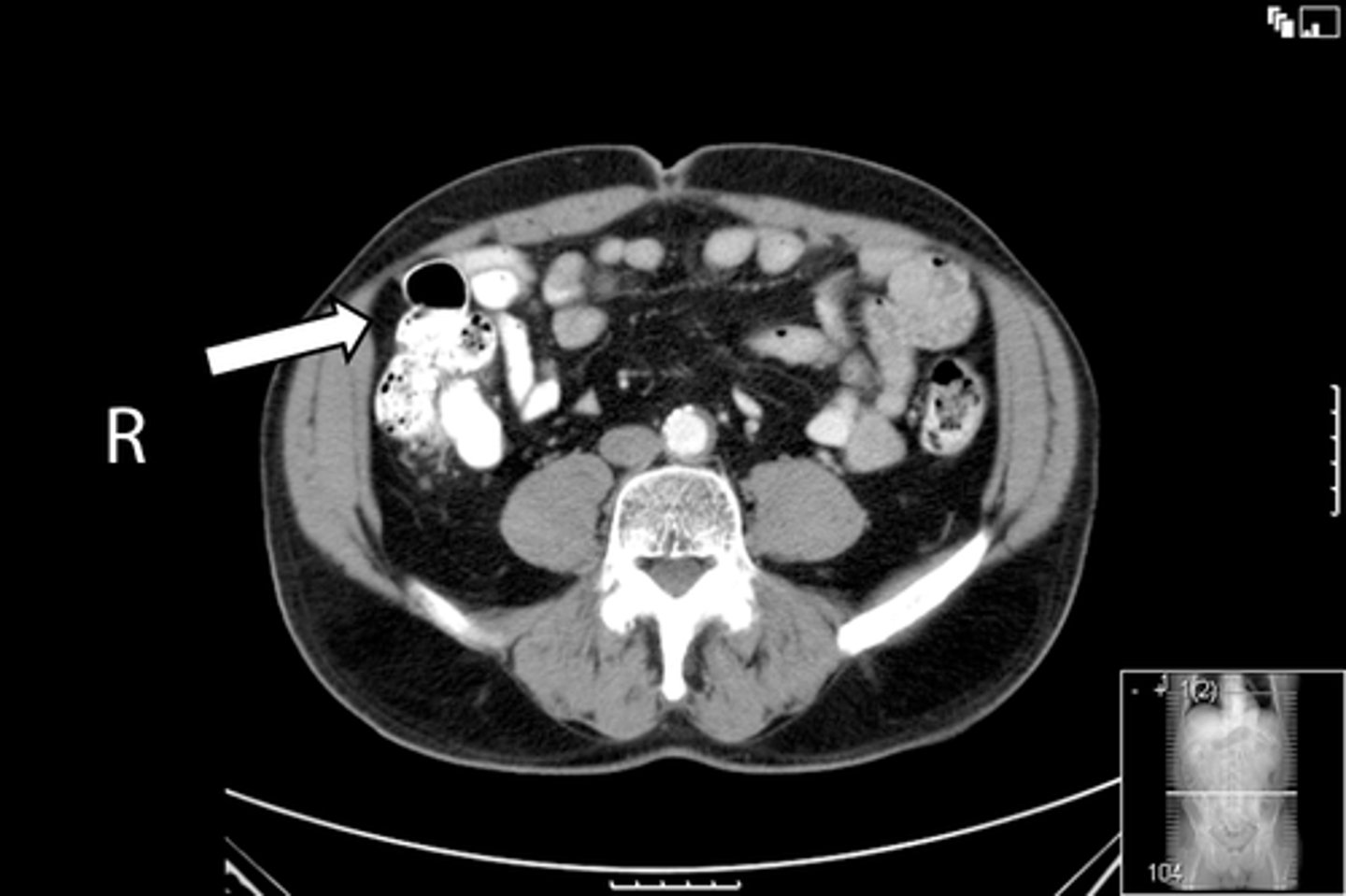 <p>What is indicated in the image?</p>