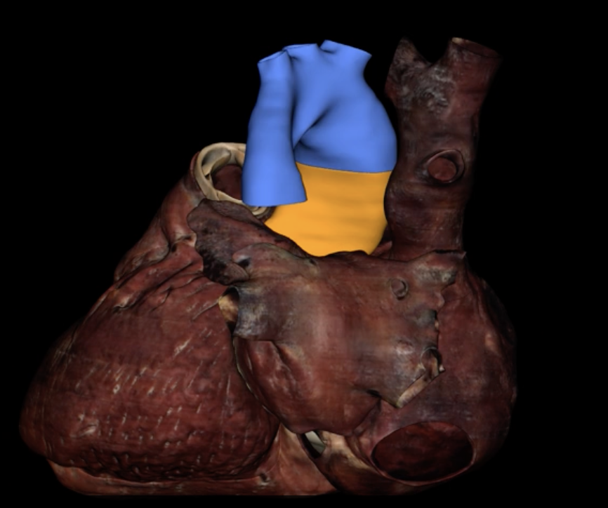 <p>What is highlighted in blue and orange?</p>