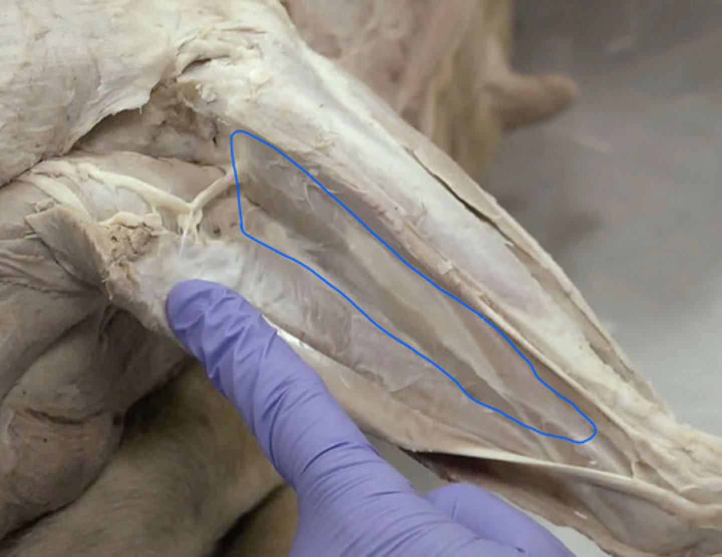 <p>se localiza debajo del m. extensor radial del carpo en la articulación del codo.</p><p>Origen: epicóndilo lt húmero</p><p>Inserción: cara md radio</p><p>Función: supinador (rotación dorsolateral del radio). Inervación: n. radial.</p>