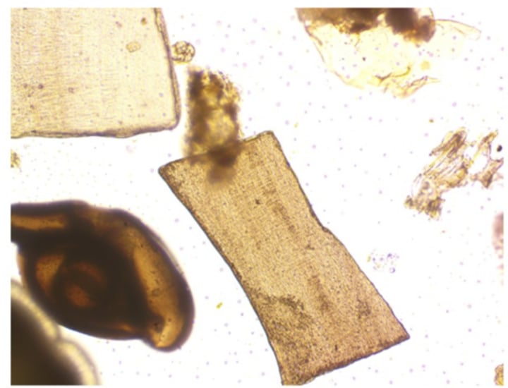 <p>What superphylum does Foraminifera belong to?</p>