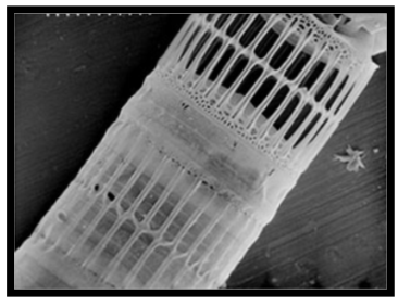<p><em>Case Study: (2) Dams, silica, and marine primary production</em></p><p>What consequences did the Danube River dams have on phytoplankton in the Black Sea? </p>