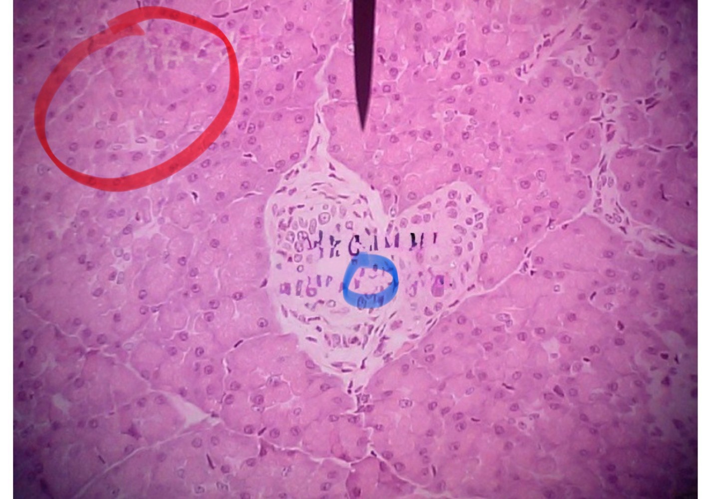 <p>Acinar Cells </p>