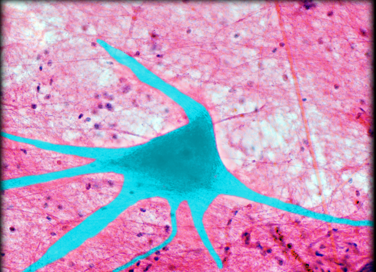 <h4 collapsed="false" seolevelmigrated="true"><strong>Location:</strong></h4><ul><li><p>Central nervous system</p></li><li><p>Ganglia of autonomic nervous system</p></li></ul><h4 collapsed="false" seolevelmigrated="true"><strong>Description:</strong></h4><ul><li><p>Composed of soma (cell body), multiple dendrites, and a single axon</p></li></ul><h4 collapsed="false" seolevelmigrated="true"><strong>Function:</strong></h4><ul><li><p>Soma contains nucleus and other cytoplasmic organelles that support neuron structure and function</p></li><li><p>Dendrites convey afferent nerve impulses (i.e., towards soma)</p></li><li><p>Axon conveys efferent nerve impulses (i.e., away from soma)</p></li></ul><h4 collapsed="false" seolevelmigrated="true"><strong>Comment:</strong></h4><ul><li><p>Neurons are the functional unit of nervous system</p></li><li><p>Three structural categories of neurons; unipolar, bipolar, and multipolar</p></li></ul>