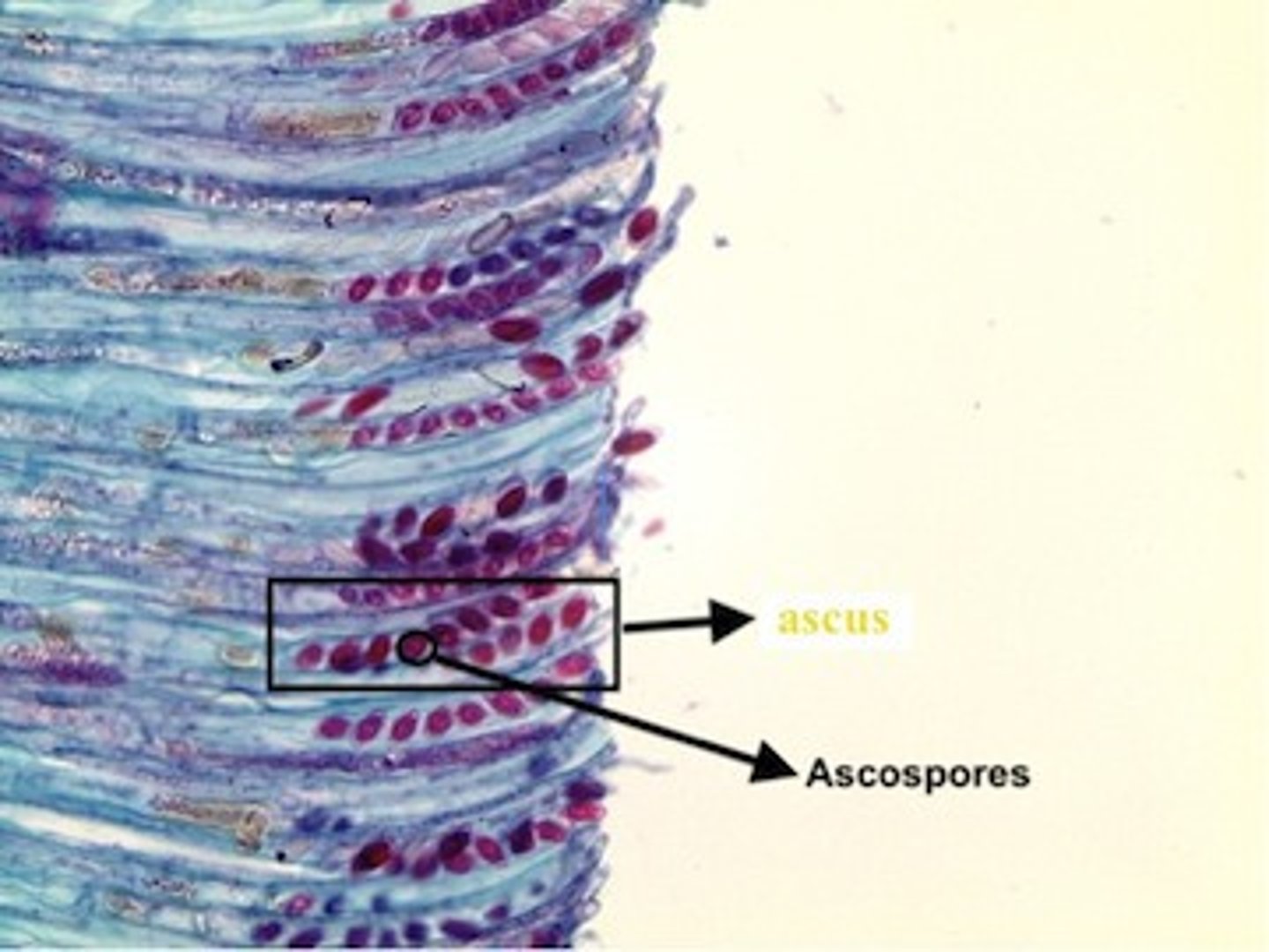 <p>sacs in ascomycetes within the ascocarp that develop at the tips of the dikaryotic hyphae</p>