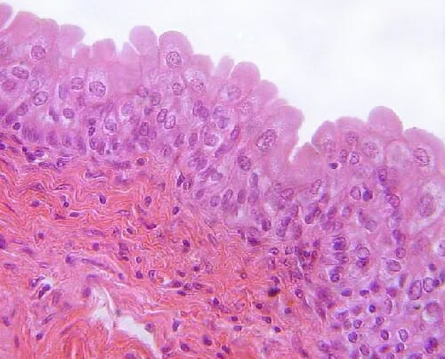 <p>Type of stratified epithelium that lines the urinary tract</p><ul><li><p><strong>stretches readily</strong> and permits distension of urinary organ by contained urine</p></li><li><p>only in the <strong>urinary system</strong>: lines the ureters, urinary <strong>bladder</strong>, and part of the urethra</p></li></ul><p></p>