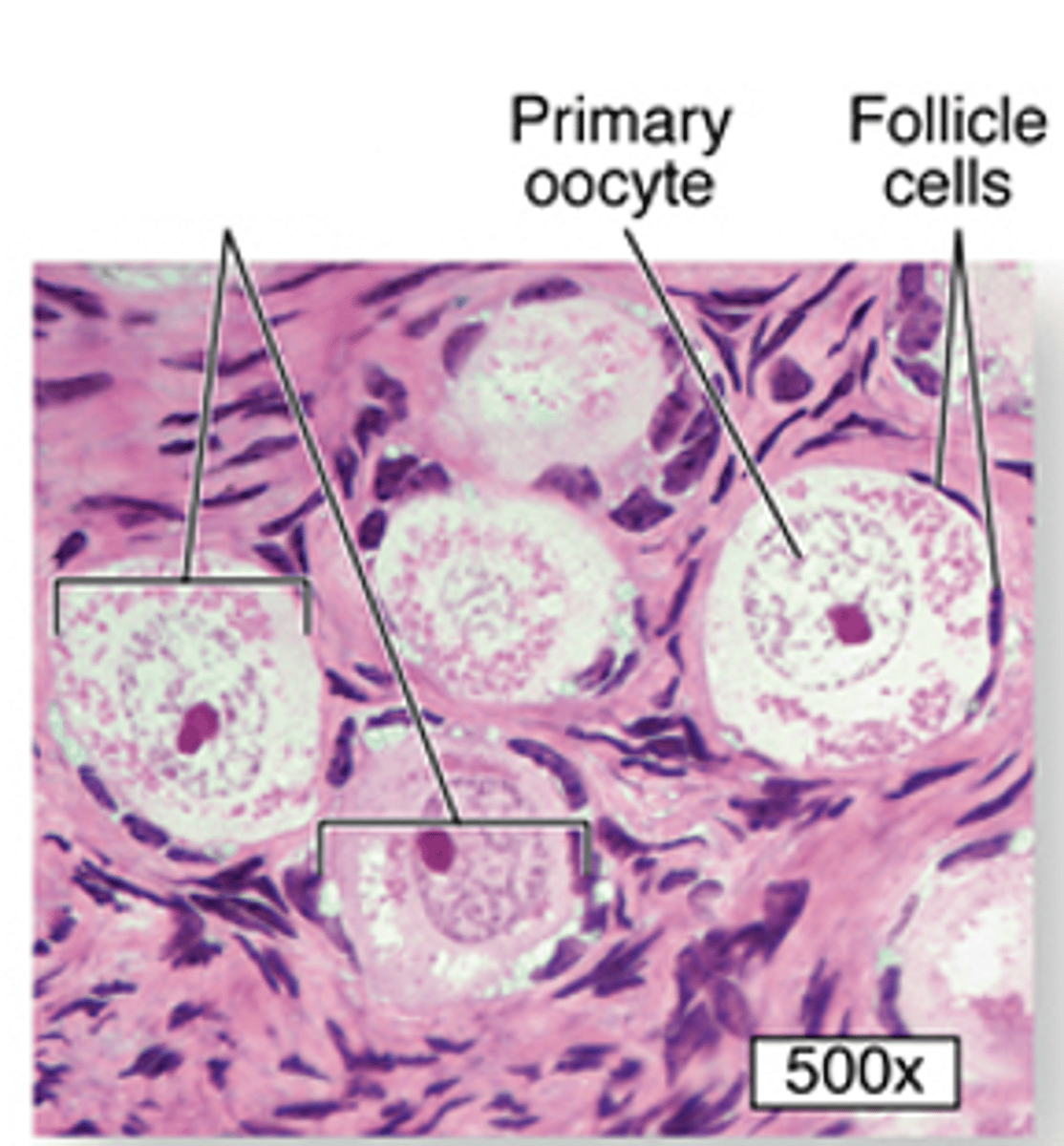 <p>ID the cell:</p>