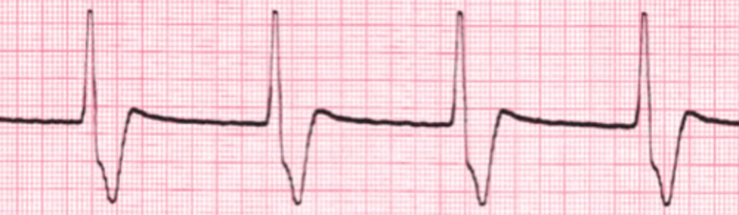 <p>Name the rhythm</p>