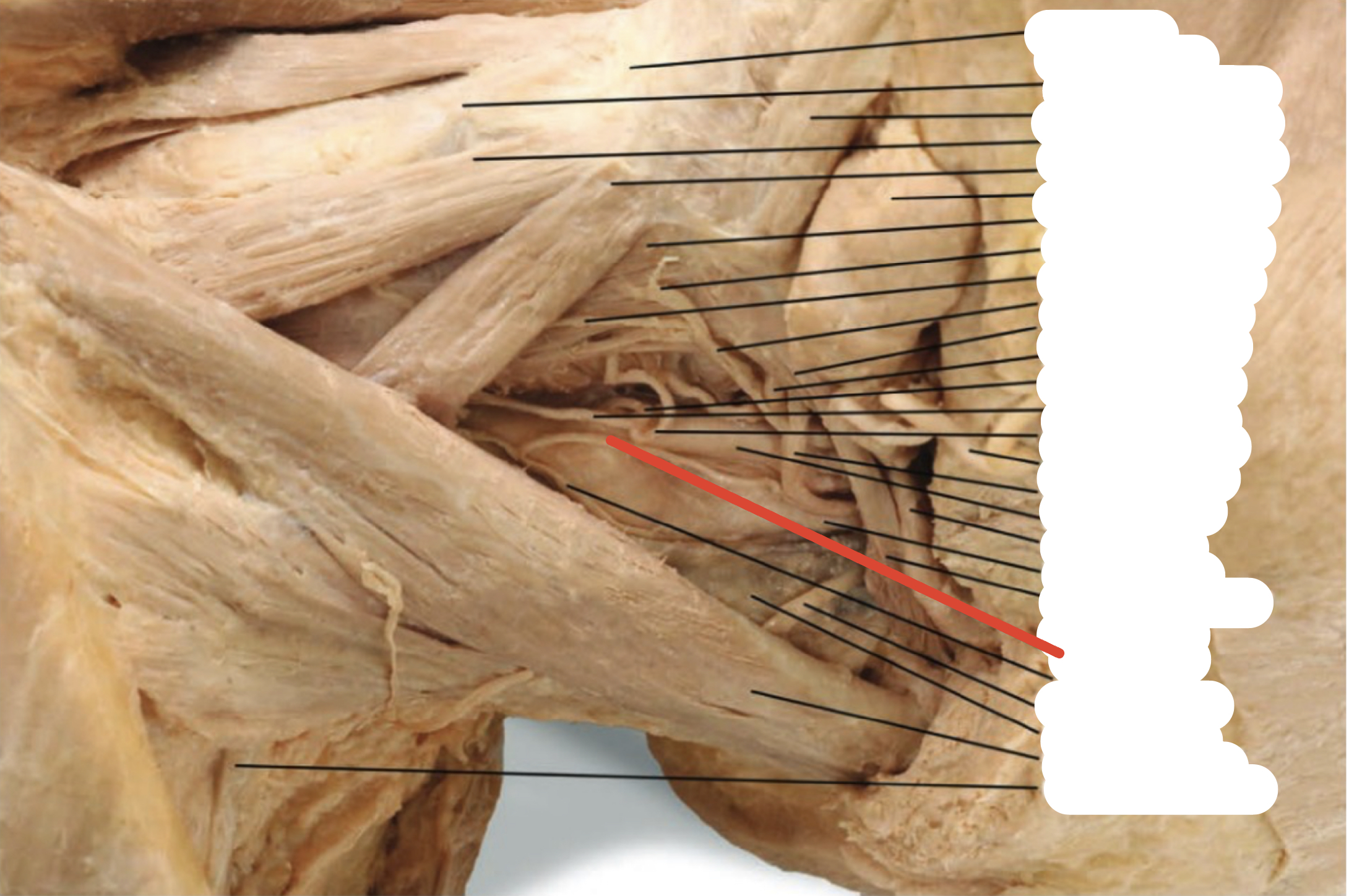 Identify the structure (red line)