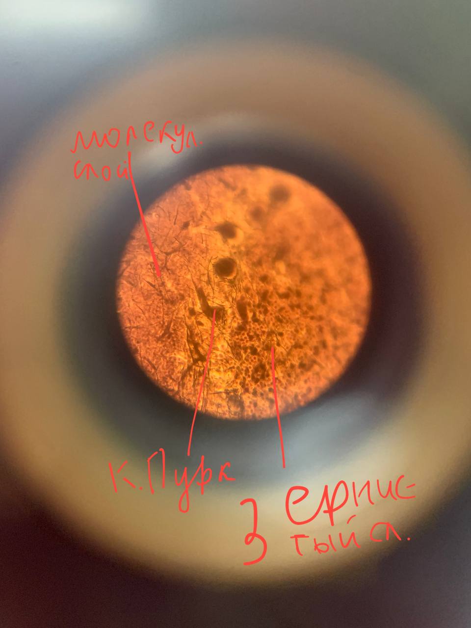 term image