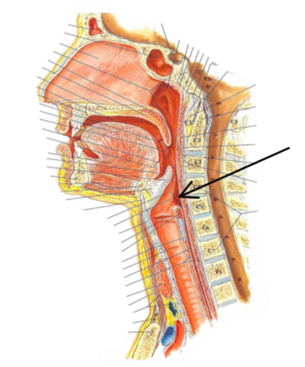 <p>Identify the structure indicated by the arrow</p>
