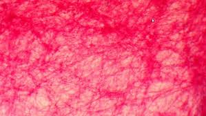 <p>beautiful cherry blossom look, tye dye hot pink&nbsp;</p>