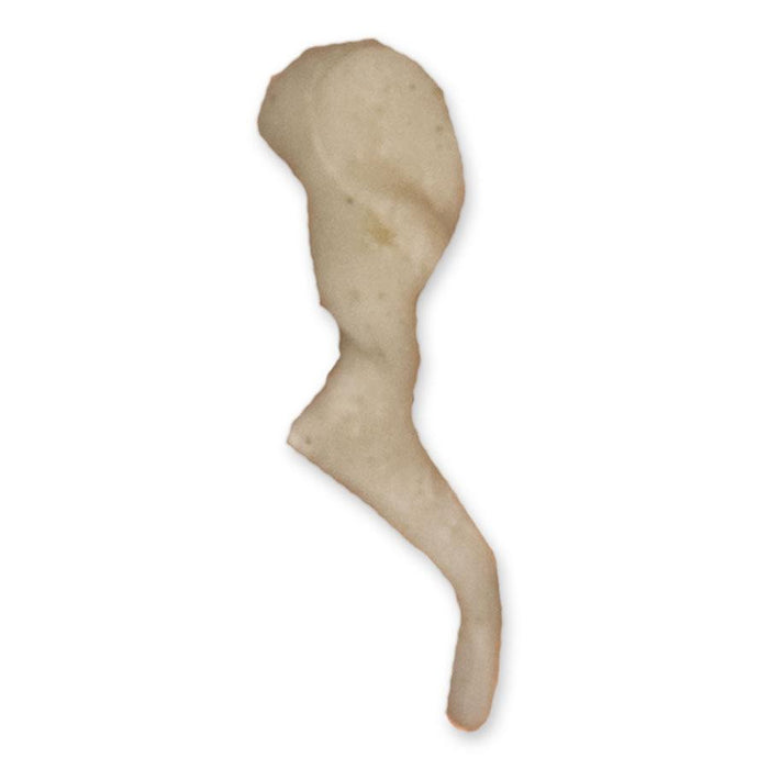 <p>Mallet shaped bone in ear, most lateral</p>