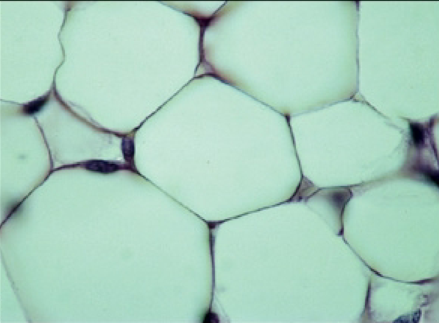 <p>What is the function of the adipose connective tissue?</p>