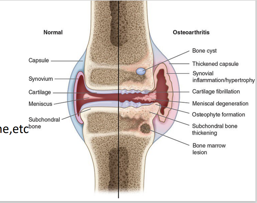 <ol><li><p>Cartilage provides <strong>lubrication, shock absorption, compressibility,</strong> and <strong>friction-free movement </strong></p></li><li><p>Cartilage turnover<strong> regulated by GFs (BMP-2, IGF-1, matrix metalloproteinases)</strong> </p></li><li><p><strong>Chrondrocytes </strong>removed damaged cartilage, increase synthesis of ECM </p></li><li><p>Supported by tendons, ligaments, subchondral bone,etc </p></li><li><p>Nourished by<strong> synovial fluid</strong></p></li></ol><p></p>
