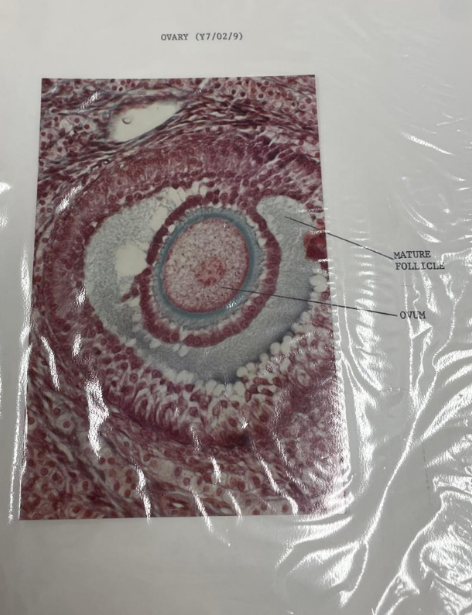 <p>ovary</p>
