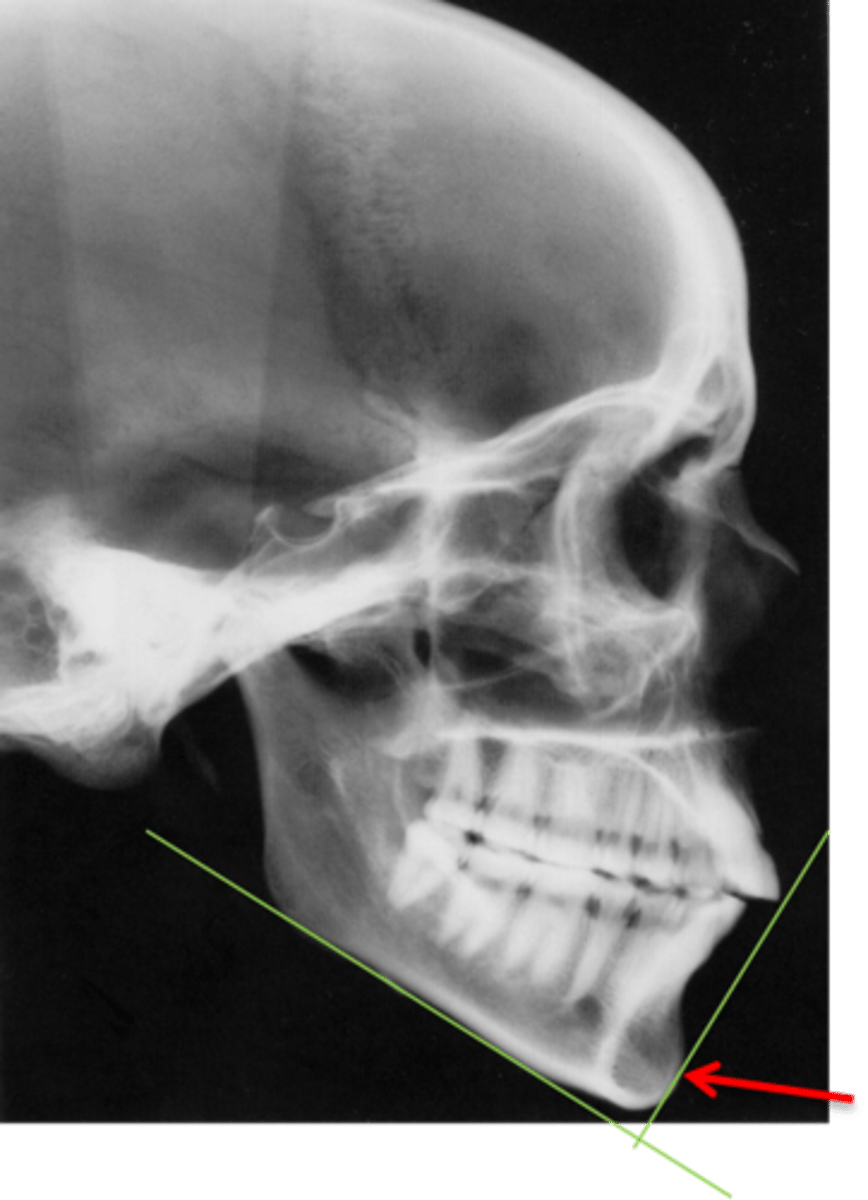 <p>What structure does this point out?</p>