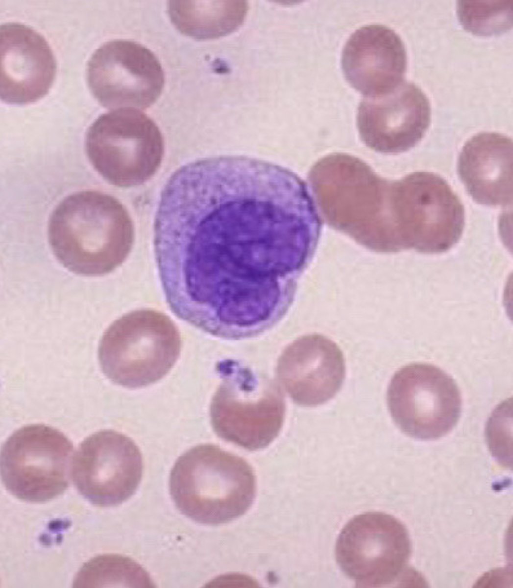 <p>What type of WBC is seen in this image?</p>