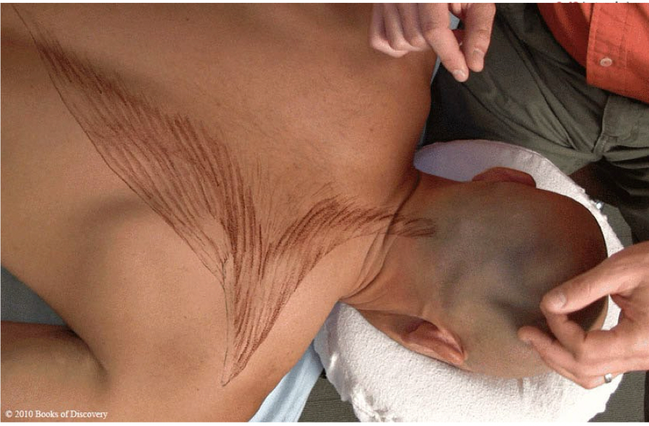 <p>Upper trapezius</p>