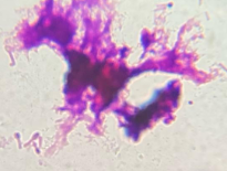 <p><span style="font-family: &quot;Segoe UI Semibold&quot;, sans-serif; line-height: 107%;"><span>Gram-positive, irregular rods with terminal endospores (matchstick).</span></span></p>