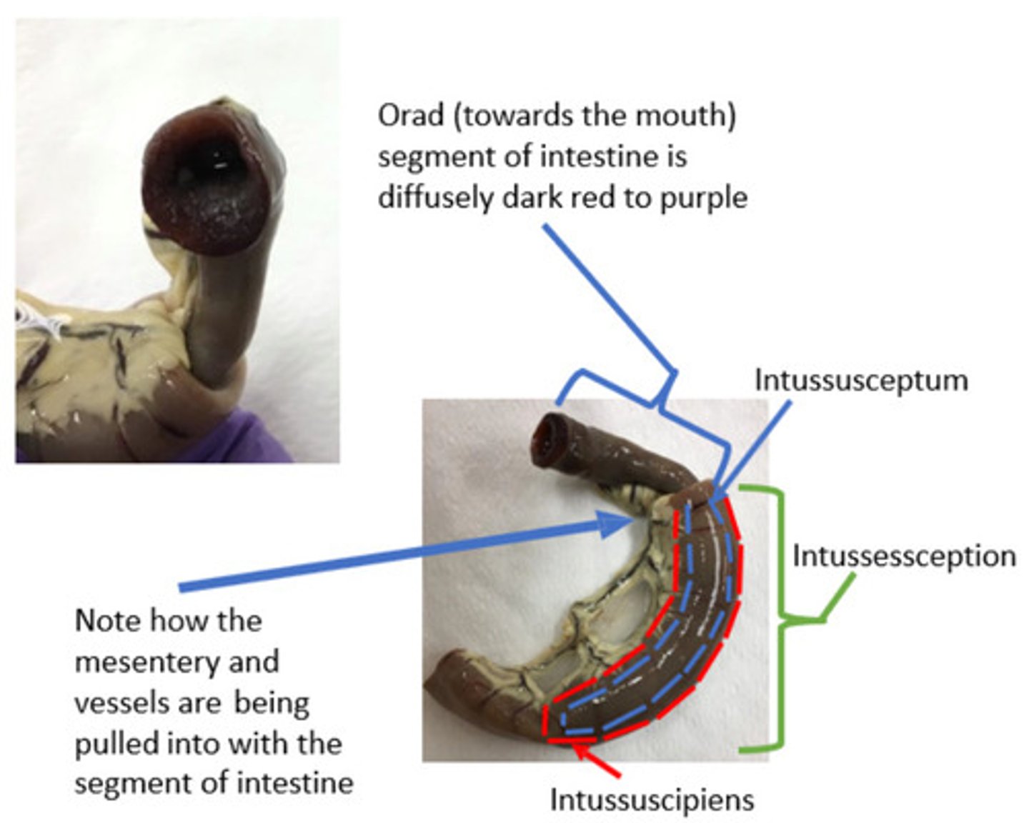 <p>What is the lesion?</p>