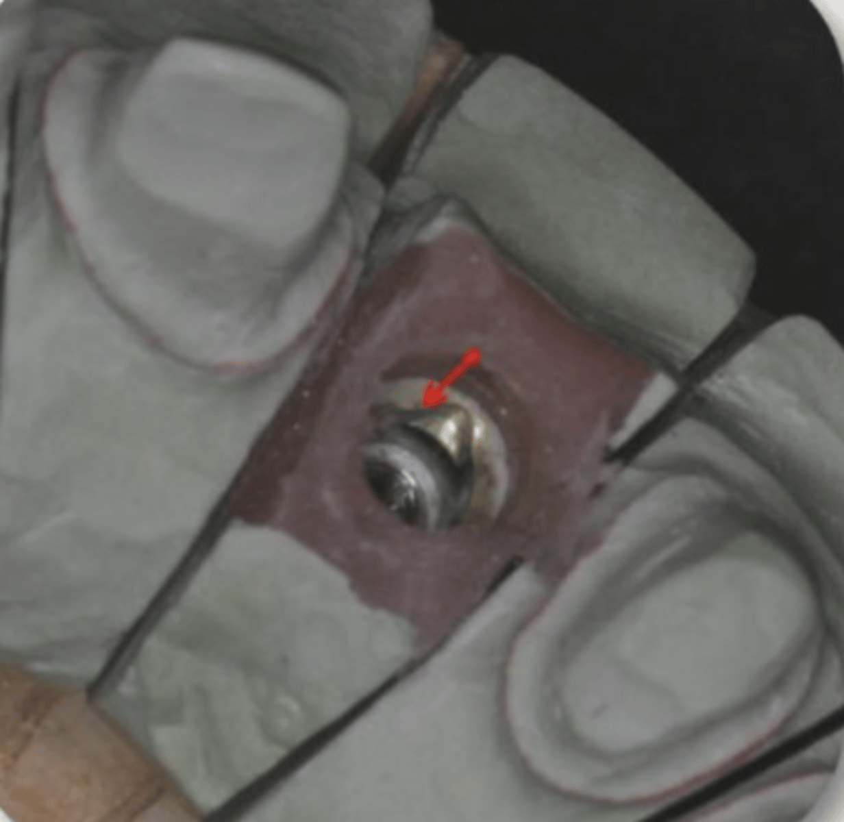 <p>Define the following:</p><p>Measure the distance (at buccal, lingual, mesial, distal) between the implant platform and the gingival margin</p>