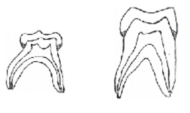 <p><span>Primary teeth: Slope Occlusally from DEJ</span><br><span>Permanent Teeth: Slope Cervically from DEJ</span></p>