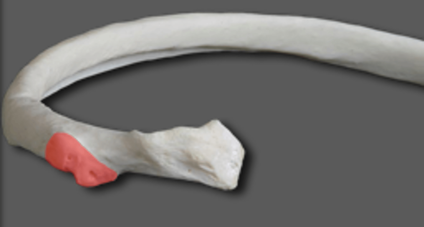 <p>Identify</p>