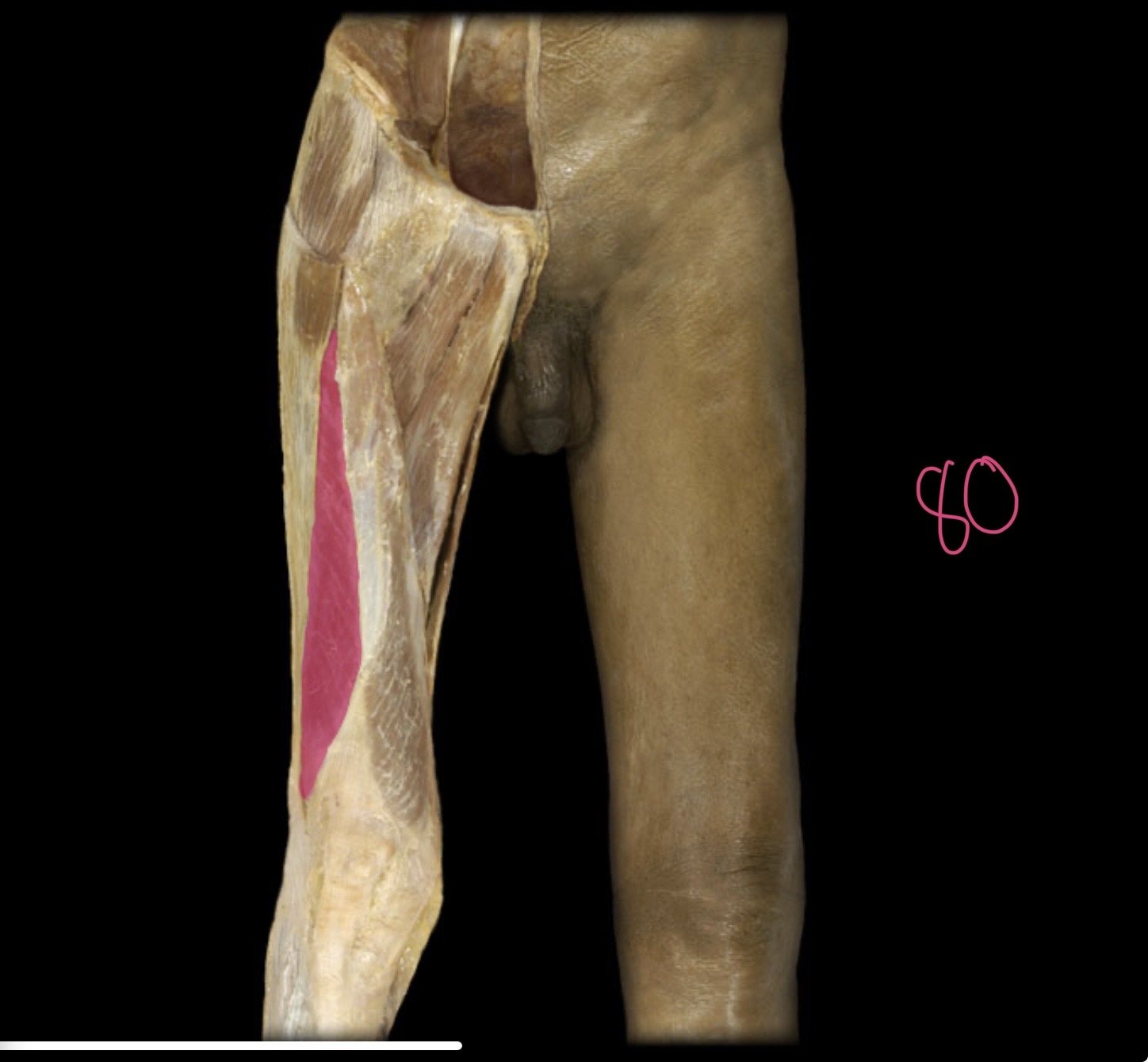 <p>Vasrus lateralis</p>