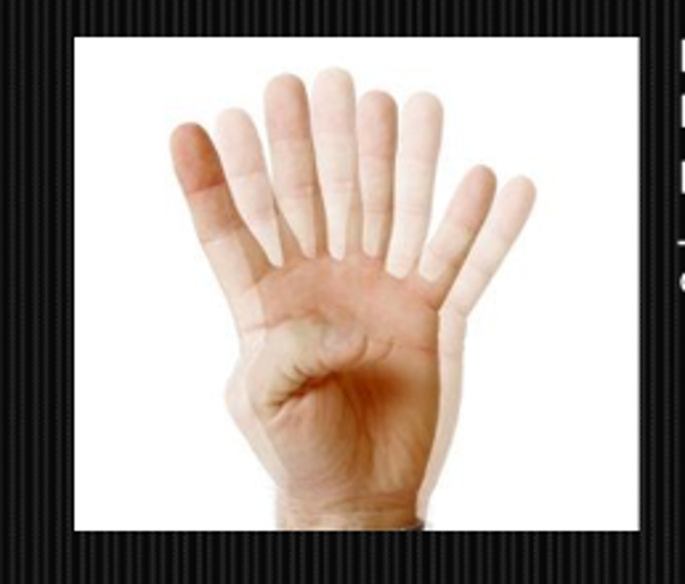 <p>monocular or binocular?</p><p>horizontal or vertical?</p><p>worse in 1 gaze?</p><p>greater at distance or near?</p><p>paralytic strab of CN 3, 4, 6 = palsy, brainstem issue, NM junction issue</p><p>decompensating phoria</p><p>eye restriction due to mechanical cause like tumors</p>