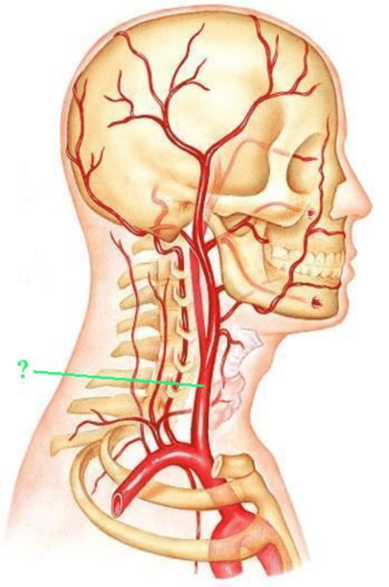 <p>Identify the indicated blood vessel.</p>