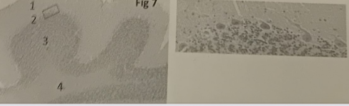 <p>25. Identify the regions in the cerebellum (figure 7):</p><p>A.1. Purkinje cells 2. Granular layer 3. Molecular layer 4. White matter</p><p>B. 1. White mater 2. Purkinje cells 3. Granular layer 4. Molecular layer</p><p>C. 1. Molecular layer 2. Purkinje cells 3.Granular layer 4. White matter</p><p>D. 1. White matter 2. Purkinje cells 3. Glial cells 4. Molecular layer</p>