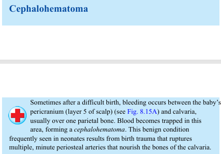 <p>Sometimes after a difficult birth, bleeding occurs between the baby’s pericranium (layer 5 of scalp) (see Fig. 8.15A) and calvaria, usually over one parietal bone. Blood becomes trapped in this area, forming a cephalohematoma. This benign condition frequently seen in neonates results from birth trauma that ruptures multiple, minute periosteal arteries that nourish the bones of the calvaria.</p>