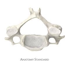 <p>Which vertebral group does this bone belong to? (cervical, thoracic, or lumbar)</p>