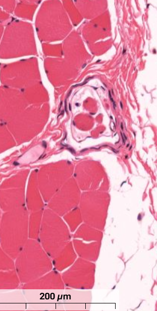 <p>What feature is shown in the skeletal muscle?</p>