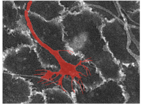 <p>incredibly ____________ start from the ________, but growth cones migrate to different locations.</p><p>filopodia explore micro-environment; cells bind and modify diverse signals; at target, form finer structures such as synapses, bouttons, etc; connect source and target cells</p><p></p>
