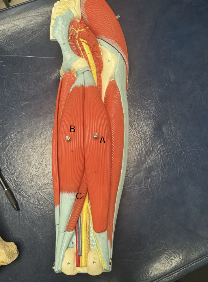 <p>Label these muscles </p>