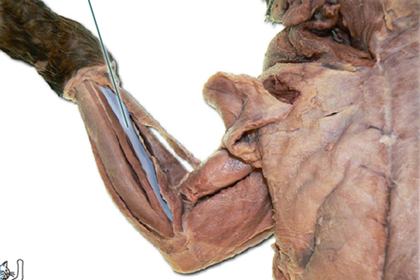 <p>origin: ulna</p><p>insertion: phalanges</p><p>action: flexes distal joints of fingers</p>