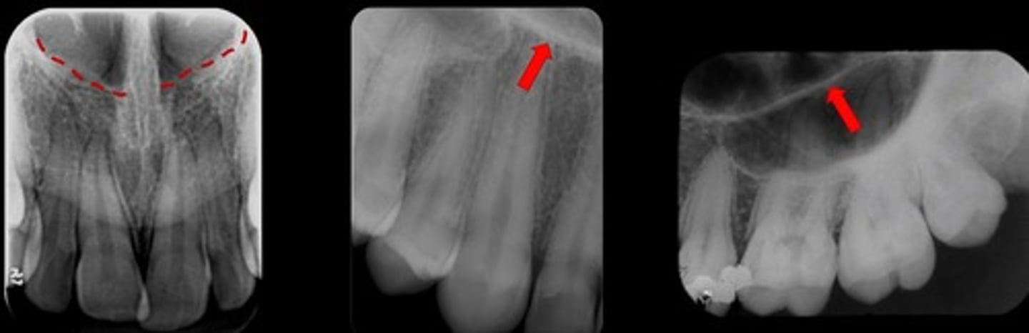 <p>What are the red arrows pointing to?</p>