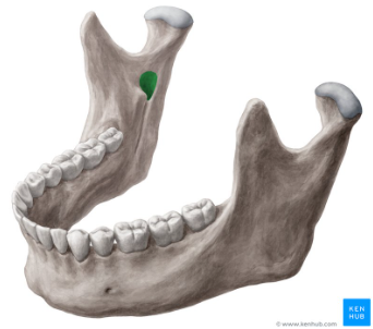 <p>What landmark in the <strong>Temporal Region </strong>is this?</p>