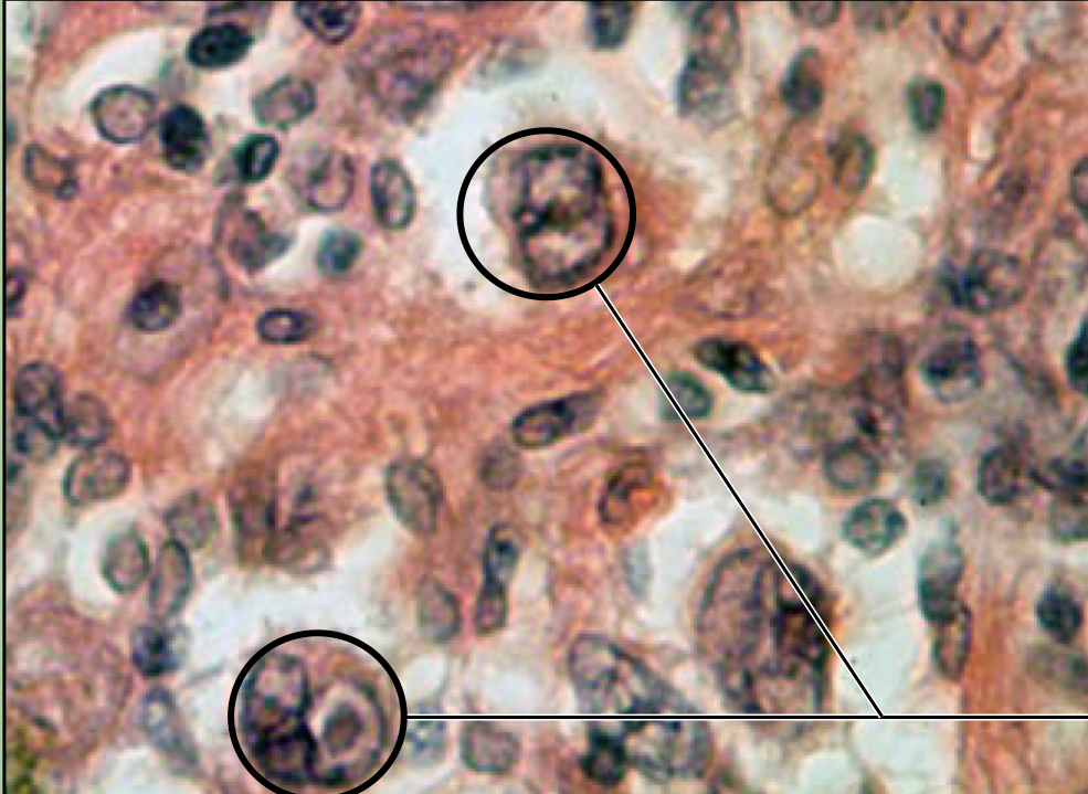 what disease is this? 