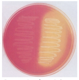 <p>Mannitol Salt Agar</p>